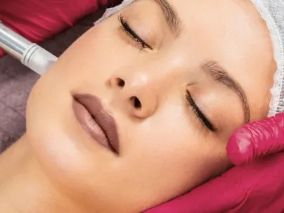 Micro-Needling Los Angeles CA