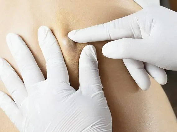 Gloved fingers pressing on a person's skin