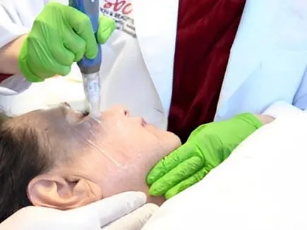 Non-surgical Hair Restoration Treatments Los Angeles CA