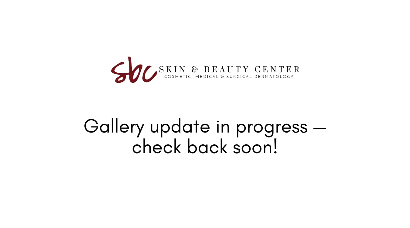 Gallery update in progress, check back soon