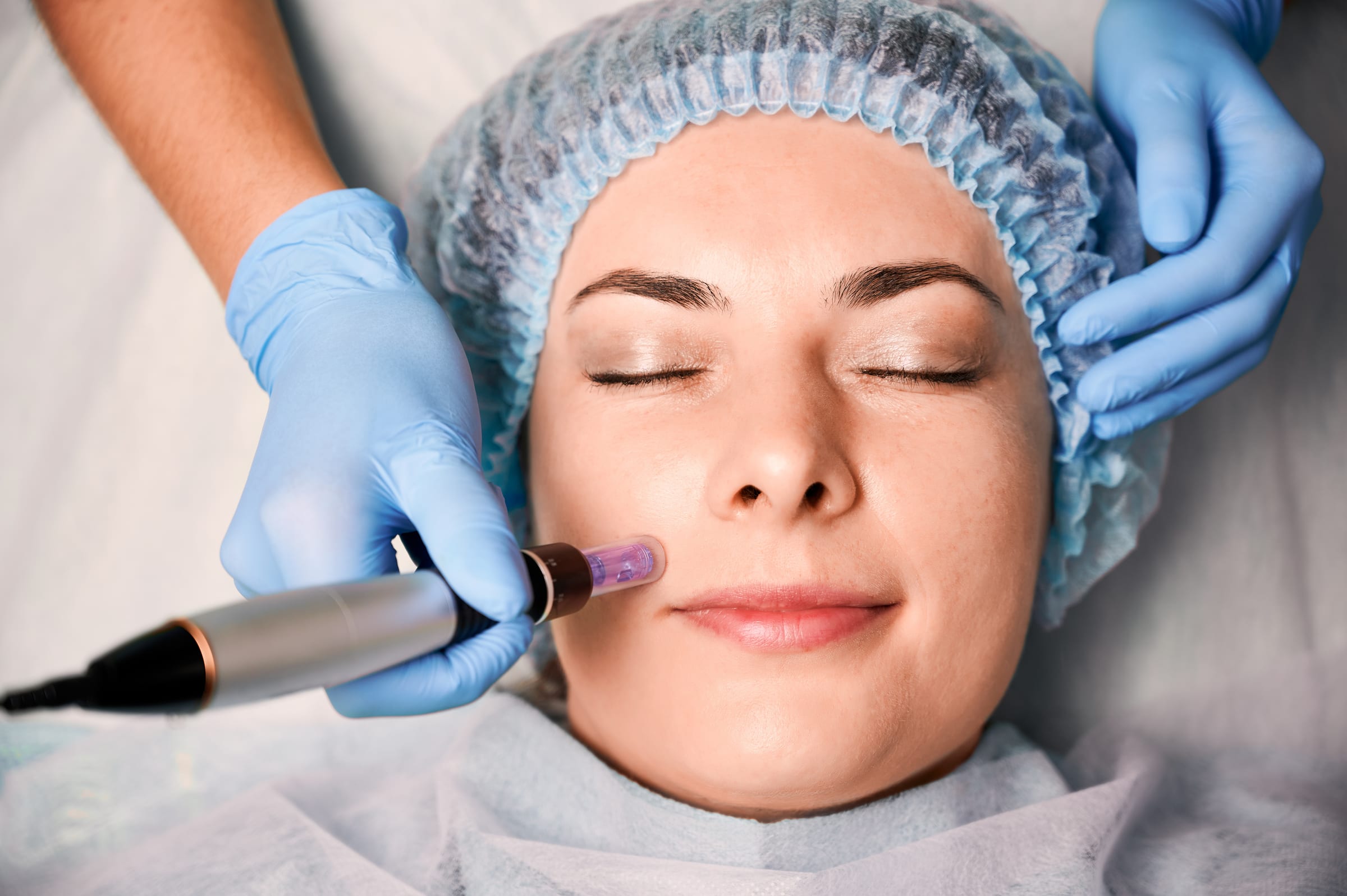 Beautician in sterile gloves using a microneedling pen on a young woman's face during a skincare treatment