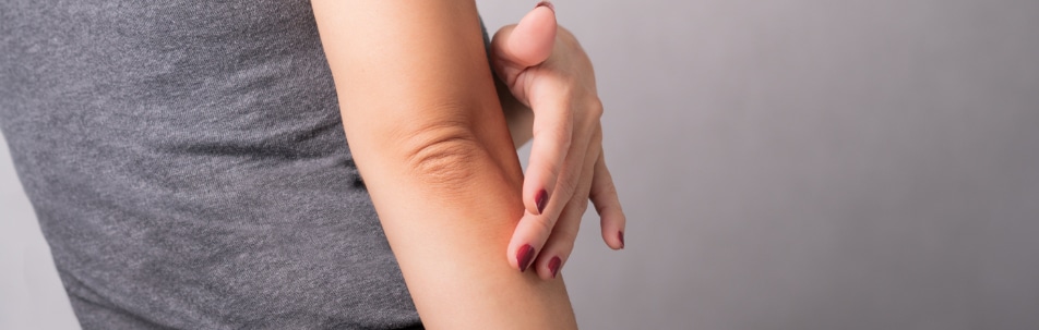 Psoriasis Treatment Los Angeles CA