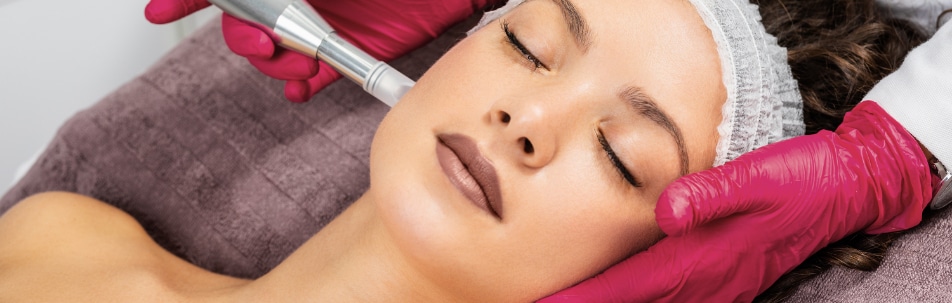 Micro-Needling Los Angeles CA