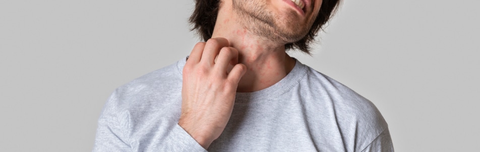 Rash Treatment Los Angeles CA