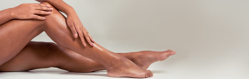 Spider & Varicose Veins Treatment Los Angeles CA