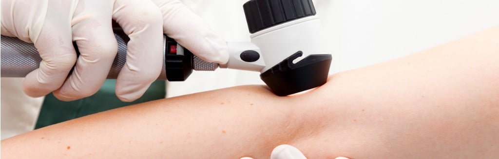 Squamous Cell Carcinoma Los Angeles CA
