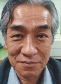 Microneedling after photo, front view (case 9336)