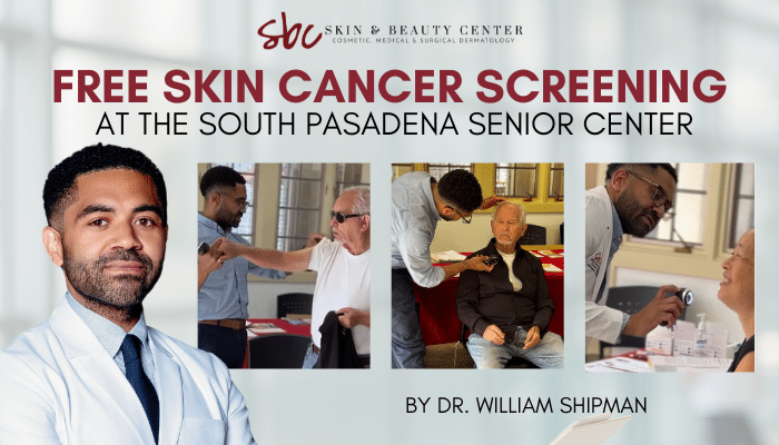 Woman looking in the mirror at sun or age spots in Los Angeles, CA