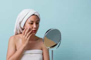 Woman looking in the mirror at her melasma in Los Angeles, CA