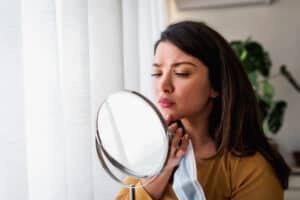 Woman looking in the mirror at her acne in Los Angeles, CA