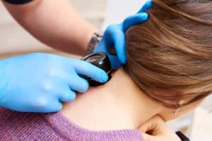 Woman having her skin checked after skin cancer in Los Angeles, CA